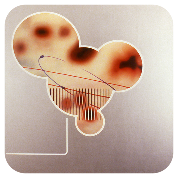 pulsonic